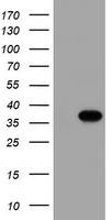 HEK293T cells were transfected with the pCMV6-ENTRY control (Left lane) or pCMV6-ENTRY MGLL (Right lane) cDNA for 48 hrs and lysed. Equivalent amounts of cell lysates (5 ug per lane) were separated by SDS-PAGE and immunoblotted with anti-MGLL.