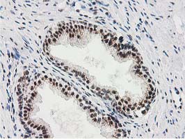 IHC of paraffin-embedded Human prostate tissue using anti-MGLL mouse monoclonal antibody. (Heat-induced epitope retrieval by 10mM citric buffer, pH6.0, 100C for 10min).