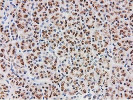IHC of paraffin-embedded Human pancreas tissue using anti-MGLL mouse monoclonal antibody. (Heat-induced epitope retrieval by 10mM citric buffer, pH6.0, 100C for 10min).
