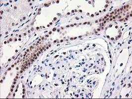 IHC of paraffin-embedded Human Kidney tissue using anti-MGLL mouse monoclonal antibody. (Heat-induced epitope retrieval by 10mM citric buffer, pH6.0, 100C for 10min).