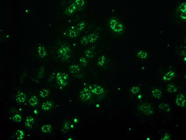 Anti-MGLL mouse monoclonal antibody immunofluorescent staining of COS7 cells transiently transfected by pCMV6-ENTRY MGLL.