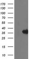 HEK293T cells were transfected with the pCMV6-ENTRY control (Left lane) or pCMV6-ENTRY MGLL (Right lane) cDNA for 48 hrs and lysed. Equivalent amounts of cell lysates (5 ug per lane) were separated by SDS-PAGE and immunoblotted with anti-MGLL.