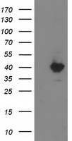 HEK293T cells were transfected with the pCMV6-ENTRY control (Left lane) or pCMV6-ENTRY MGLL (Right lane) cDNA for 48 hrs and lysed. Equivalent amounts of cell lysates (5 ug per lane) were separated by SDS-PAGE and immunoblotted with anti-MGLL.