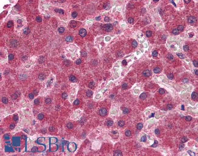 Anti-MGLL antibody IHC of human liver. Immunohistochemistry of formalin-fixed, paraffin-embedded tissue after heat-induced antigen retrieval. Antibody LS-B4376 concentration 3.75 ug/ml.