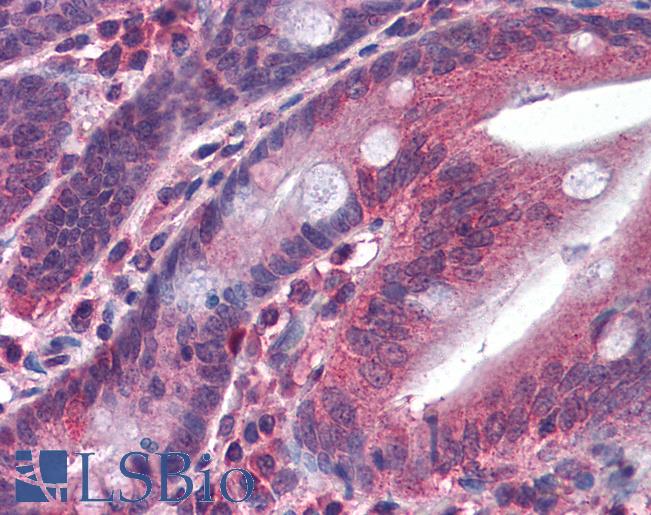 Anti-MGLL antibody IHC of human small intestine. Immunohistochemistry of formalin-fixed, paraffin-embedded tissue after heat-induced antigen retrieval. Antibody LS-B4376 concentration 3.75 ug/ml.