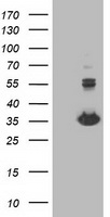 HEK293T cells were transfected with the pCMV6-ENTRY control (Left lane) or pCMV6-ENTRY MGLL (Right lane) cDNA for 48 hrs and lysed. Equivalent amounts of cell lysates (5 ug per lane) were separated by SDS-PAGE and immunoblotted with anti-MGLL.
