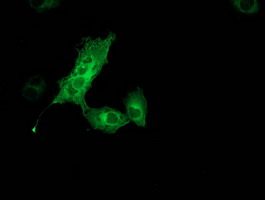 Anti-MGLL mouse monoclonal antibody immunofluorescent staining of COS7 cells transiently transfected by pCMV6-ENTRY MGLL.