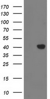 HEK293T cells were transfected with the pCMV6-ENTRY control (Left lane) or pCMV6-ENTRY MGLL (Right lane) cDNA for 48 hrs and lysed. Equivalent amounts of cell lysates (5 ug per lane) were separated by SDS-PAGE and immunoblotted with anti-MGLL.