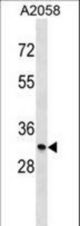 MGLL Antibody western blot of A2058 cell line lysates (35 ug/lane). The MGLL antibody detected the MGLL protein (arrow).