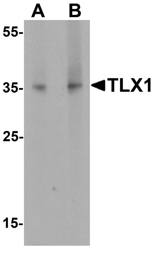 Western blot analysis of TLX1 in mouse spleen tissue lysate with TLX1 antibody at (A) 1 ug/ml and (B) 2 ug/ml.
