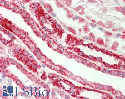 Human Kidney: Formalin-Fixed, Paraffin-Embedded (FFPE)