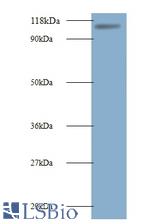 Western blot of E3 ubiquitin-protein ligase MIB1 antibody at 2ug/ml + 293T whole cell lysate. Secondary: Goat polyclonal to Rabbit IgG at 1:10000 dilution. Predicted band size: 111 kDa. Observed band size: 111 kDa.