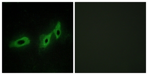 Immunofluorescence of HeLa cells, using TRI18 Antibody. The picture on the right is treated with the synthesized peptide.