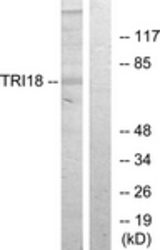 Western blot of extracts from 293 cells, using TRI18 Antibody. The lane on the right is treated with the synthesized peptide.