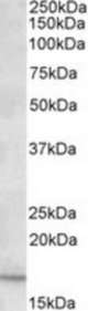 CXCL2 antibody (0.2 ug/ml) staining of Human Duodenum lysate (35 ug protein/ml in RIPA buffer). Primary incubation was 1 hour. Detected by chemiluminescence