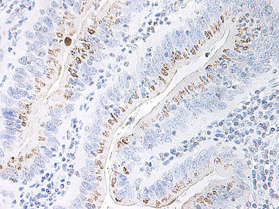 IHC of MIP-2 / CXCL2 antibody LS-C104840