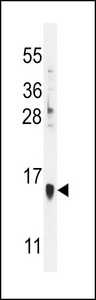 MART-1/Melan-A Antibody western blot of HL-60 cell line lysates (35 ug/lane). The MART-1/Melan-A antibody detected the MART-1/Melan-A protein (arrow).
