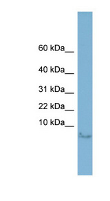 MLN / Motilin antibody LS-C107950 Western blot of HT1080 cell lysate.