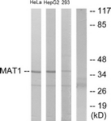 Western blot of extracts from HeLa/HepG2/293 cells, using MAT1 Antibody. The lane on the right is treated with the synthesized peptide.