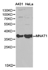 Western blot of extracts of various cell lines, using MNAT1 antibody.