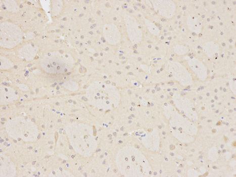 Immunohistochemistry of paraffin-embedded rat brain using MNAT1 antibody at dilution of 1:200 (200x lens).