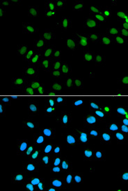Immunofluorescence analysis of MCF7 cell using MNAT1 antibody. Blue: DAPI for nuclear staining.