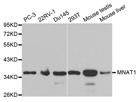 Western blot analysis of extracts of various cell lines, using MNAT1 antibody.