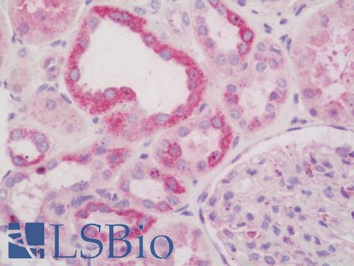 Human Kidney: Formalin-Fixed, Paraffin-Embedded (FFPE)