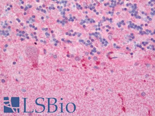 Human Brain, Cerebellum: Formalin-Fixed, Paraffin-Embedded (FFPE)