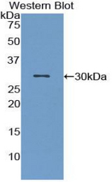 Western blot of recombinant MST1.