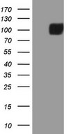 HEK293T cells were transfected with the pCMV6-ENTRY control (Left lane) or pCMV6-ENTRY MST1 (Right lane) cDNA for 48 hrs and lysed. Equivalent amounts of cell lysates (5 ug per lane) were separated by SDS-PAGE and immunoblotted with anti-MST1 (1:2000).