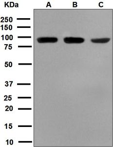 Western blot analysis on (A) HepG2, (B) 293T, and (C) Caco-2 cell lysates using anti-MSP antibody.