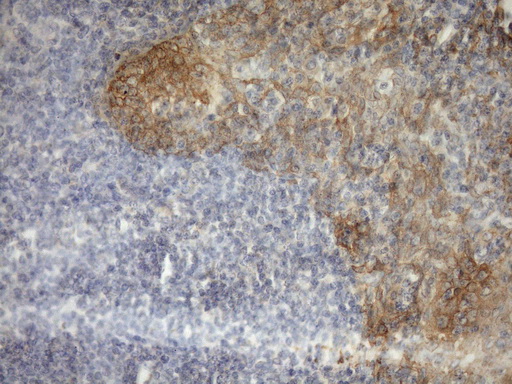 IHC of paraffin-embedded Human tonsil using anti-MST1 mouse monoclonal antibody. (Heat-induced epitope retrieval by Tris-EDTA, pH8.0)(1:150).