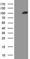 HEK293T cells were transfected with the pCMV6-ENTRY control (Left lane) or pCMV6-ENTRY MST1 (Right lane) cDNA for 48 hrs and lysed. Equivalent amounts of cell lysates (5 ug per lane) were separated by SDS-PAGE and immunoblotted with anti-MST1 (1:2000).