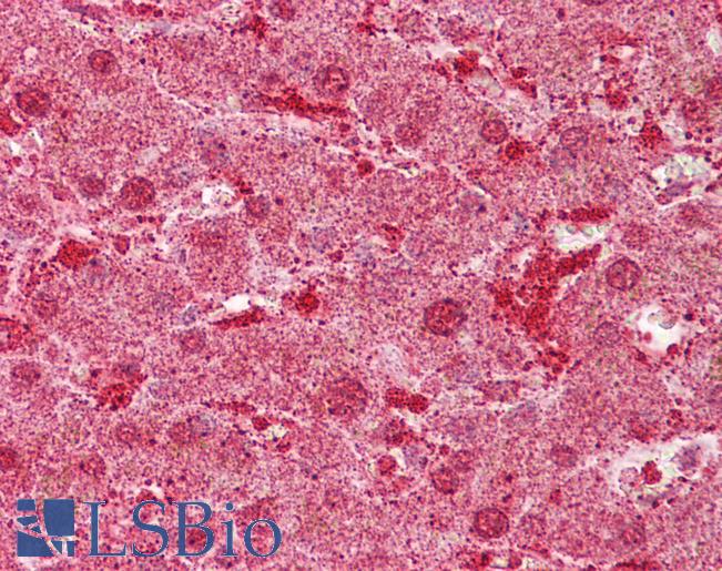 Anti-MST1 antibody IHC of human liver. Immunohistochemistry of formalin-fixed, paraffin-embedded tissue after heat-induced antigen retrieval. Antibody LS-B6630 concentration 5 ug/ml.