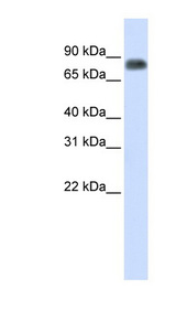 MST1 antibody LS-B6630 Western blot of Fetal Lung lysate.