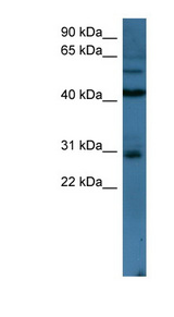TLX2 antibody LS-C135073 Western blot of 721_B cell lysate.