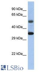 MTERF antibody Western Blot of Fetal Kidney. Antibody dilution: 1 ug/ml.