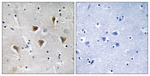 IHC of paraffin-embedded human brain tissue, using MTERF Antibody. The picture on the right is treated with the synthesized peptide.