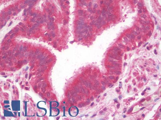 Anti-MTERFD1 antibody IHC staining of human lung. Immunohistochemistry of formalin-fixed, paraffin-embedded tissue after heat-induced antigen retrieval. Antibody LS-B10092 concentration 10 ug/ml.