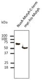 Western blot. Anti-Mutyh antibody at 1:1000 dilution. Recombinant protein at 50 ng and 293HEK transfected lysate at 100 ug per lane. Rabbit polyclonal to goat IgG (HRP) at 1:10000 dilution.