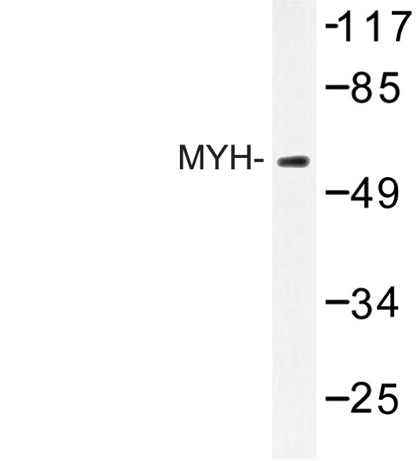 Western blot of MYH (Y176) pAb in extracts from HepG2 cells.