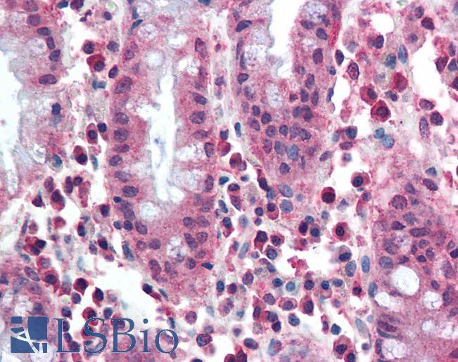Anti-MUTYH antibody IHC of human colon. Immunohistochemistry of formalin-fixed, paraffin-embedded tissue after heat-induced antigen retrieval. Antibody LS-B1974 concentration 10 ug/ml.