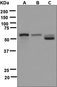 Western blot analysis on (A) K562, (B) Jurkat, and (C) HepG2 cell lysates using anti-MYH antibody.