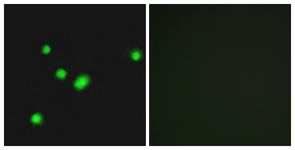 Immunofluorescence of A549 cells, using MUTYH Antibody. The picture on the right is treated with the synthesized peptide.