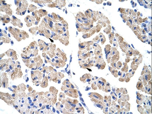 TLX2 antibody LS-C30693 was used in IHC to stain formalin-fixed, paraffin-embedded human muscle.