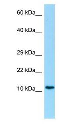 C19orf10 / SF20 antibody Western Blot of Human Placenta.