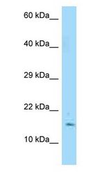 C19orf10 / SF20 antibody Western Blot of MCF7.