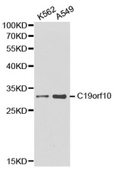 Western blot analysis of K562 cell and A549 cell lysate using C19orf10 antibody.
