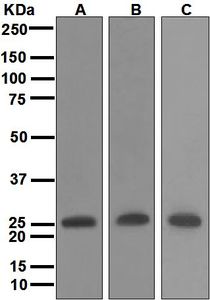 Western blot analysis on (A) fetal muscle, (B) human skeletal muscle, and (C) human heart lysates using anti-Myosin Light Chain 4 antibody.